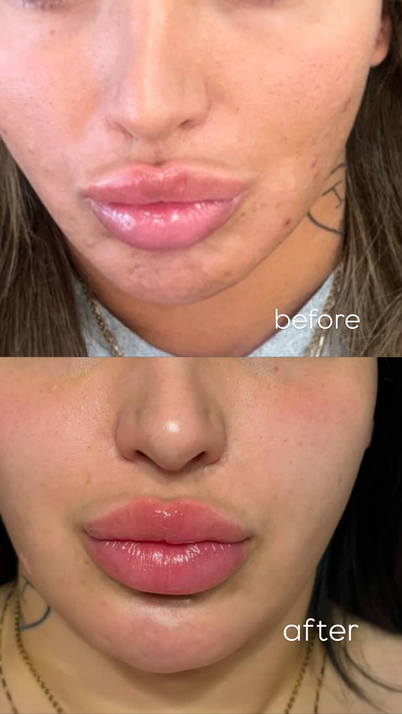 2 for $40 Normal/Combination Crema Tepezchouite