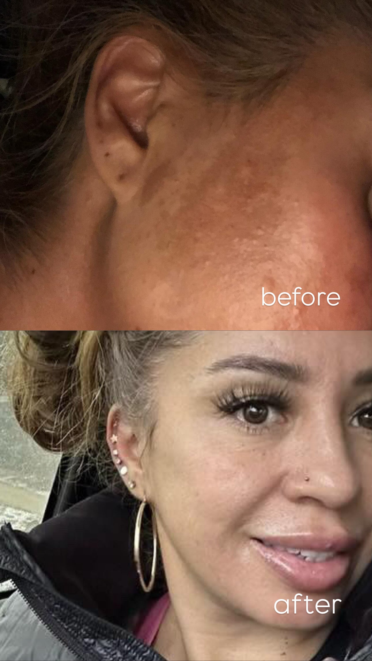 2 for 40$ Dry Skin Creama Tepezchouite